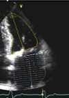 Echocardiography (TTE)